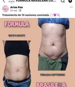 Arias Pao, recomienda el curso de aparatología estética online